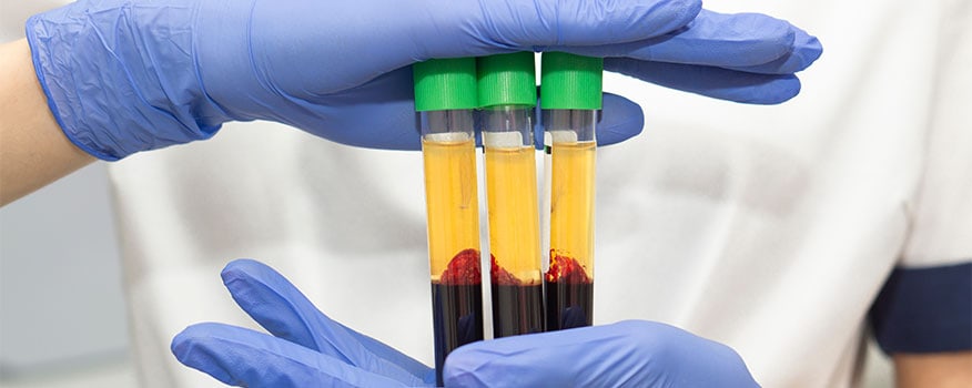 Is PRP Right for You? Understanding the Candidacy and Success of PRP Injections for Joint Pain Tampa, FL