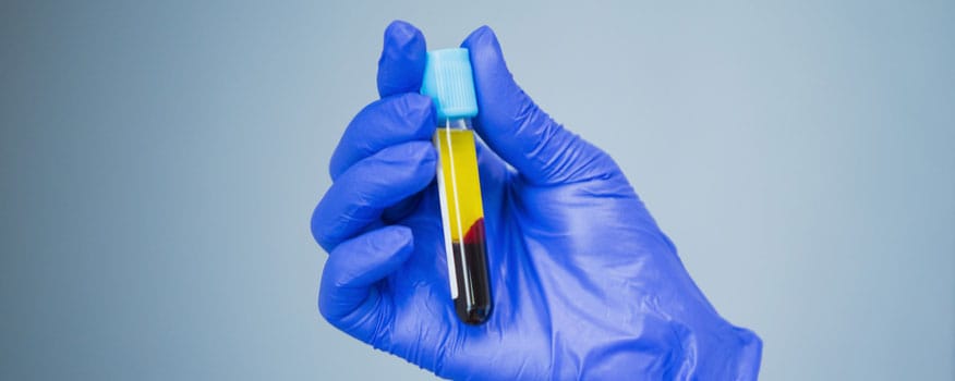 PRP for Chronic Pain