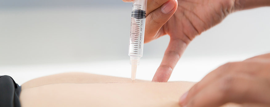 What Are Trigger Point Injections? Tampa, FL